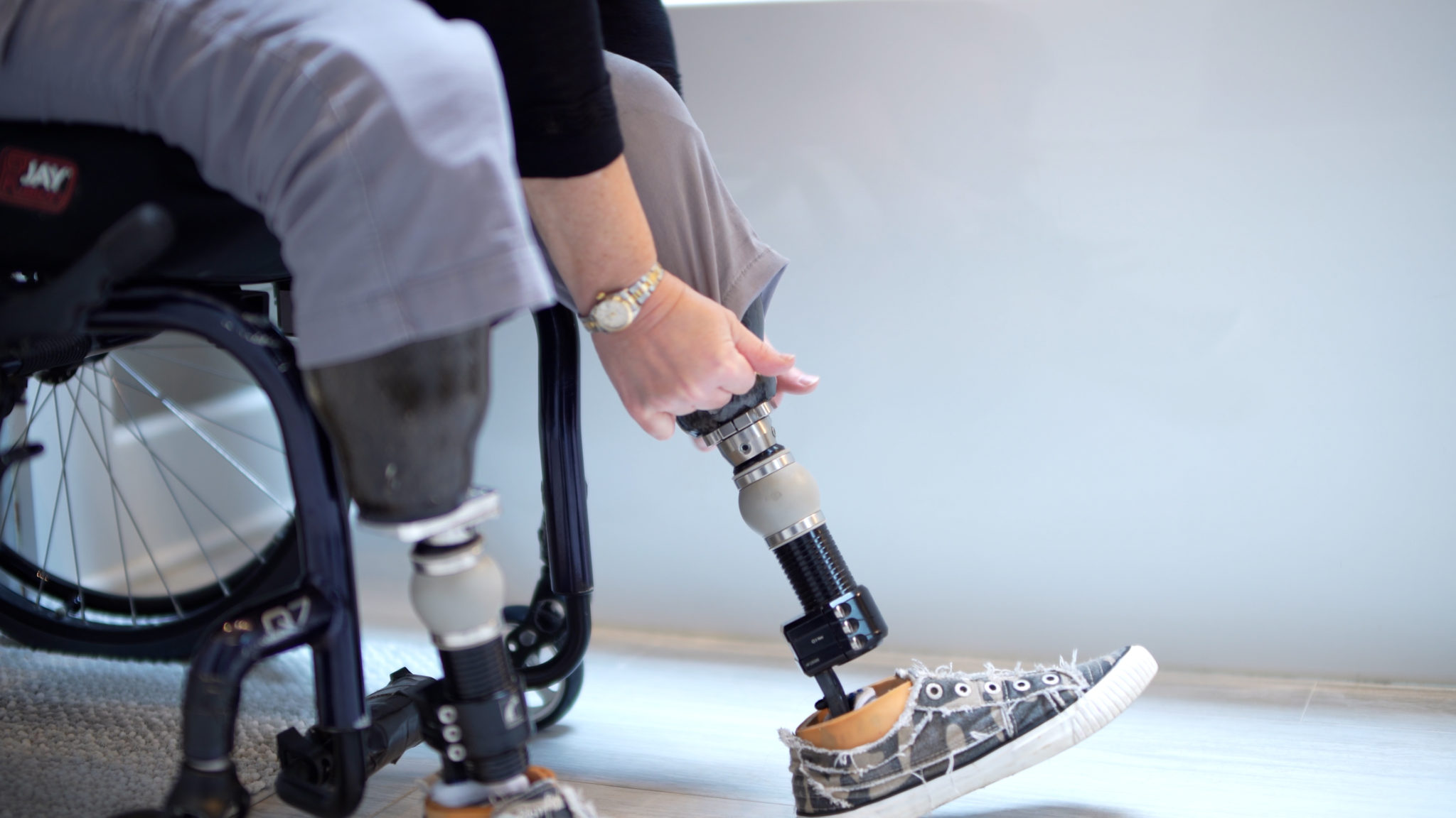 Different Types Of Lower-Limb Prostheses