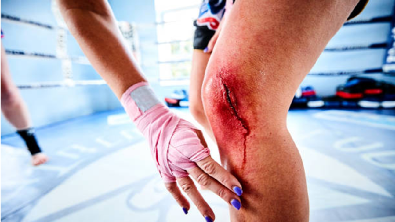 Common Injuries in Boxing and How to Prevent Them