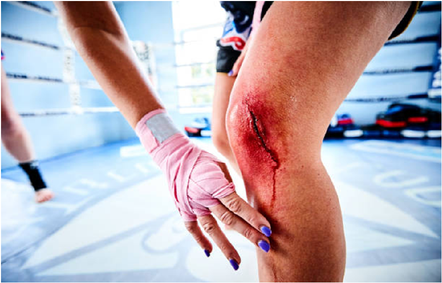 Common Injuries in Boxing and How to Prevent Them